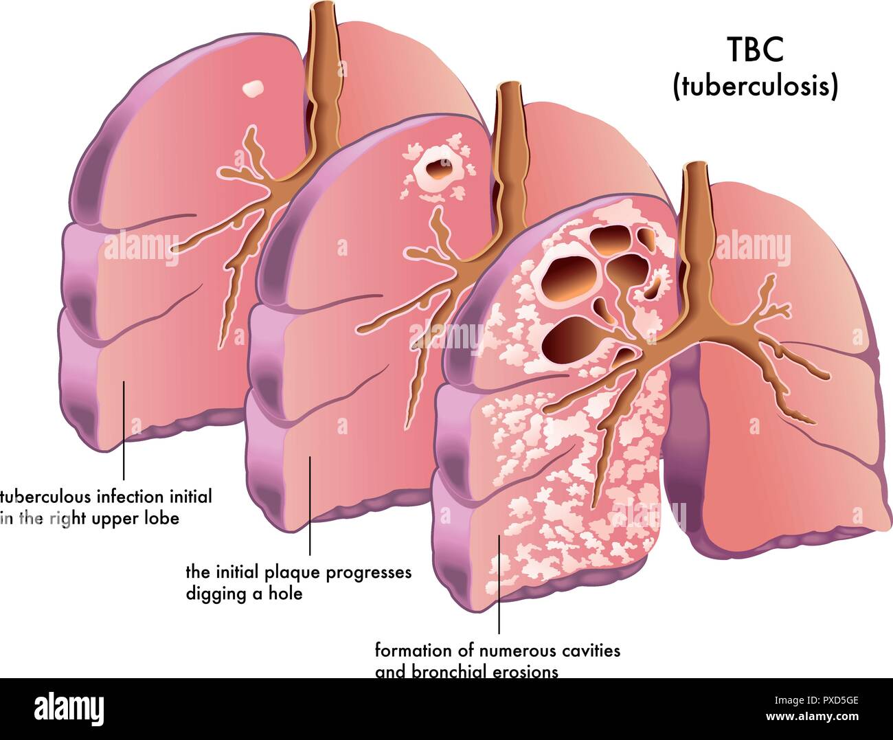 TB-500 (Thymosin Beta-4) 5mg (1 vial)